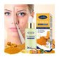 GUANJING Tumeric Face Serum Anti - Acne Face Repair