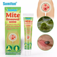 Mite Removal Ointment | Topical Cream for Eliminating Scabies Rash, Pubic Lice, and Mites