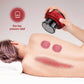 Intelligent Breathing Cupping Massage Device