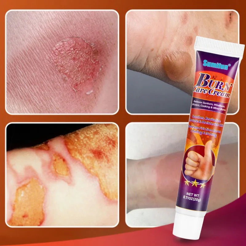 Burn Scald Ointment Burn Scar Removal Pain Relief Antibacterial Cream Repairing Skin Redness Swelling Anti Fungal Health Care