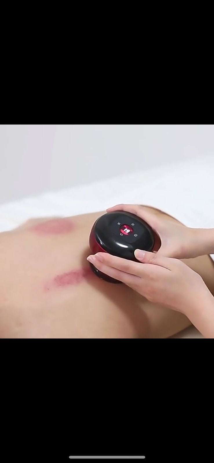 Intelligent Breathing Cupping Massage Device