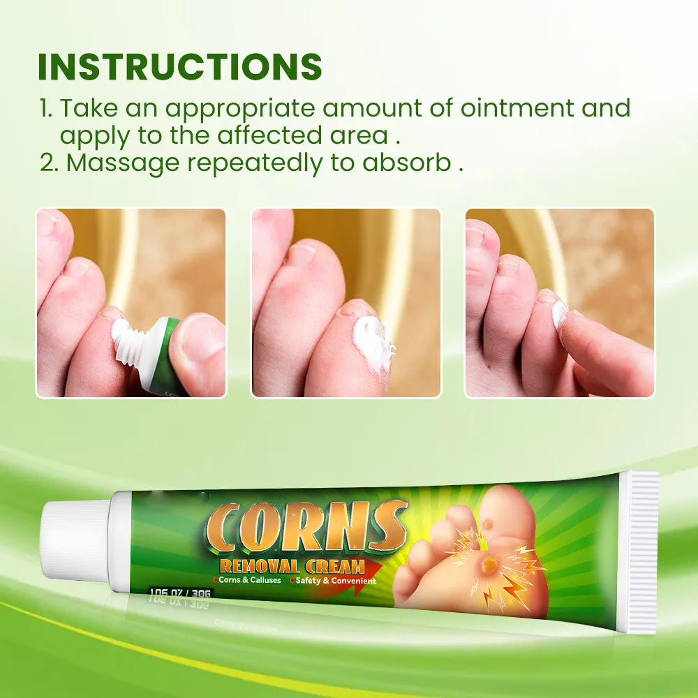 Sumifun Foot Corn Remover Cream Chicken Eye Skin Infection Treatment Ointment Feet Dead Skin Calluses