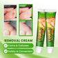 Sumifun Foot Corn Remover Cream Chicken Eye Skin Infection Treatment Ointment Feet Dead Skin Calluses