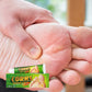 Sumifun Foot Corn Remover Cream Chicken Eye Skin Infection Treatment Ointment Feet Dead Skin Calluses