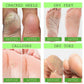 AC High Quality Foot Repair & Fungal Elimination Cream