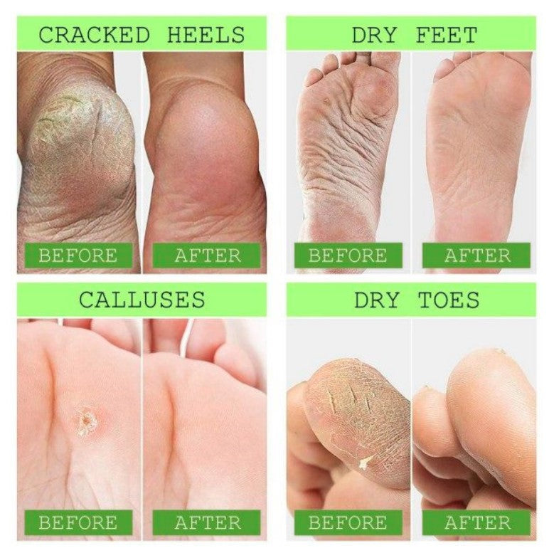 AC High Quality Foot Repair & Fungal Elimination Cream