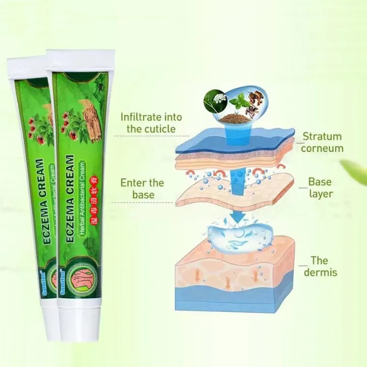 Effective Sumifun Eczema Treatment Cream gamot sa kati kati sa balat buni Psoriasis Treatment Cream Ointment for Itchy Skin