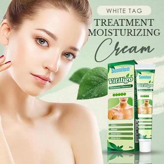 Sumifun Vitiligo Treatment Ointment - Vitiligo Remover & Vitiligo Cream. (20G)