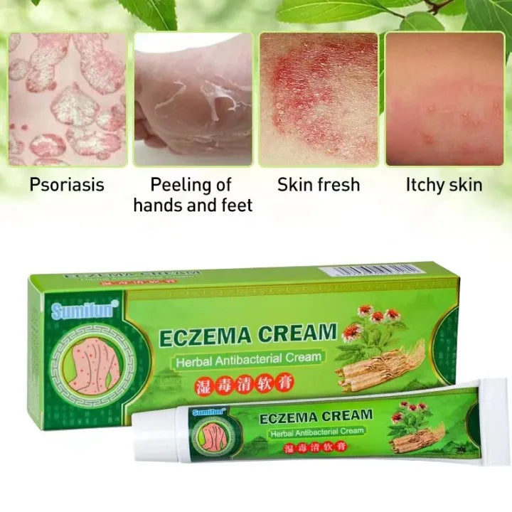 Effective Sumifun Eczema Treatment Cream gamot sa kati kati sa balat buni Psoriasis Treatment Cream Ointment for Itchy Skin