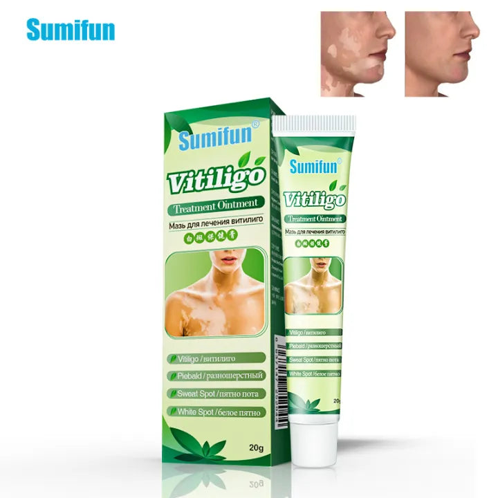 Sumifun Vitiligo Treatment Ointment - Vitiligo Remover & Vitiligo Cream. (20G)